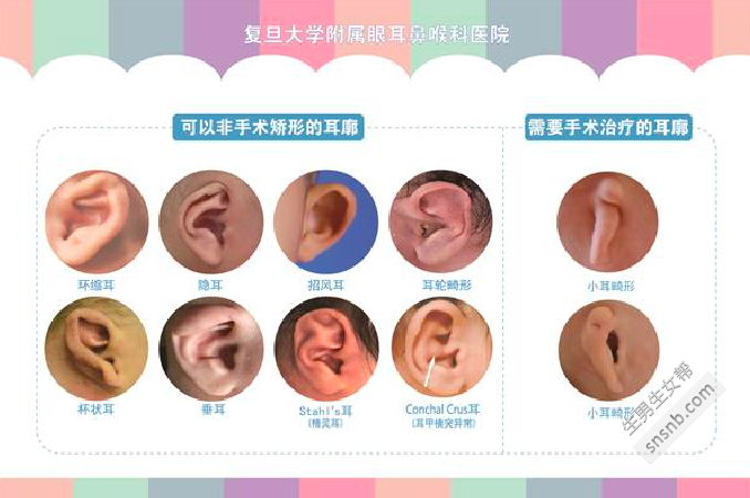 有多少家长错过了对招风耳、精灵耳和先天性耳廓畸形的非手术矫正？...